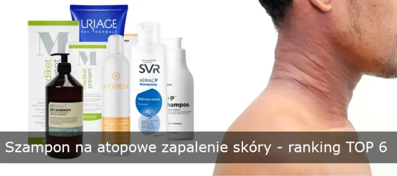 Preparaty obok zaczerwienionej skóry karku