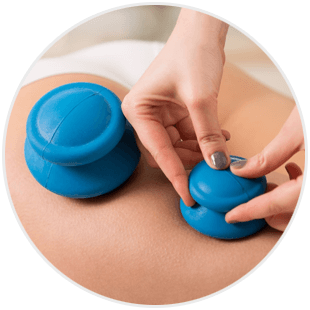 Bańki chińskie na cellulit